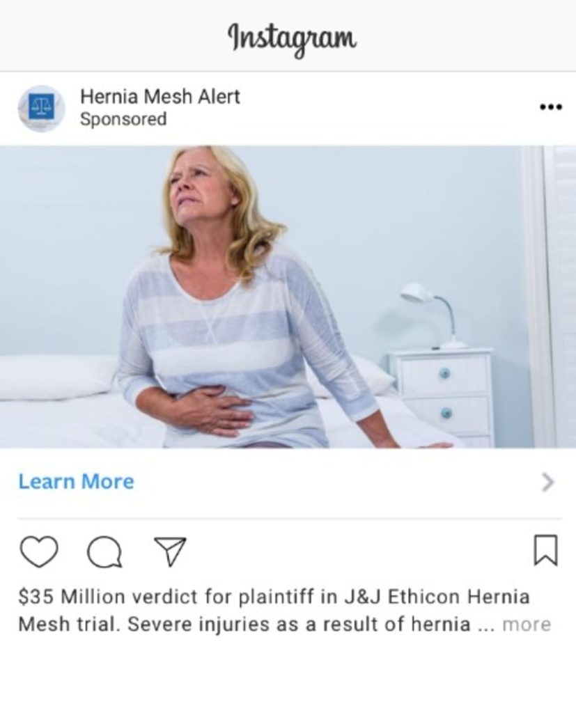 Photo representing Hernia Mesh cases as a social media ad for injury lawyer marketing